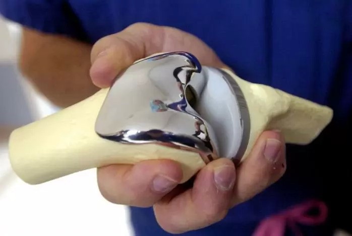 Ендопротезування (заміна) кульшового суглоба: показання до операції